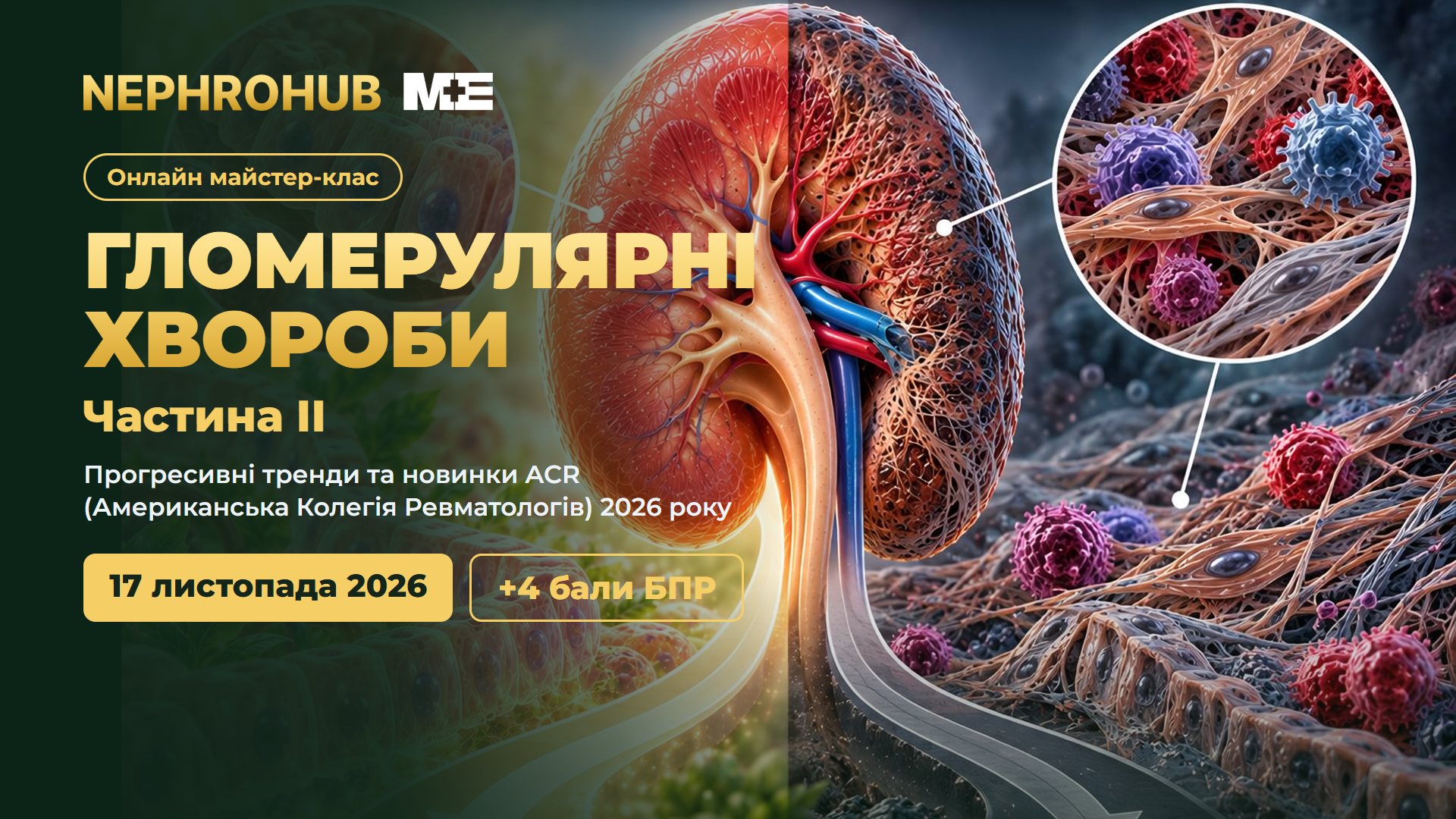 NephroHub. Онлайн майстер-клас «Гломерулярні хвороби. Частина II: прогресивні тренди та новинки ACR (Американська Колегія Ревматологів) 2026 року», 17 листопада 2026, +4 бали БПР